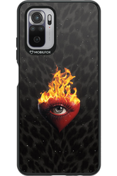 Shit happens - Xiaomi Redmi Note 10