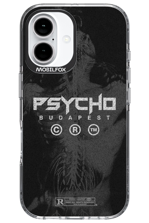X-Ray - Apple iPhone 16
