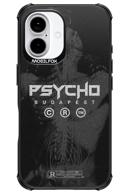 X-Ray - Apple iPhone 16