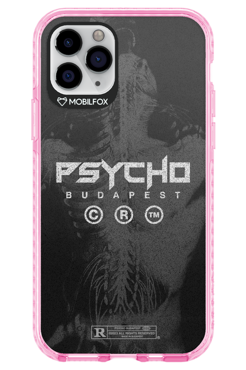 X-Ray - Apple iPhone 11 Pro