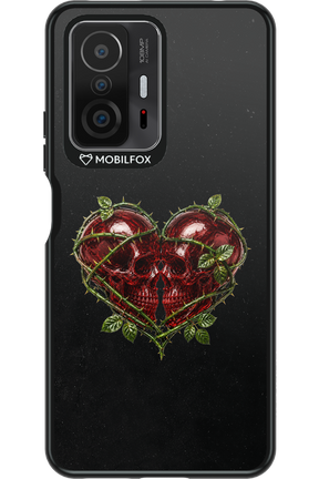 Omen Kiss 2.0 - Xiaomi Mi 11T Pro