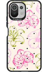 Aloha Chic 2.0 - Xiaomi Mi 11 Lite (2021)