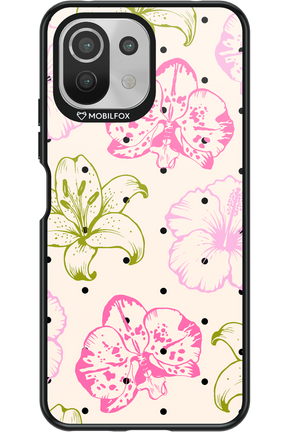 Aloha Chic 2.0 - Xiaomi Mi 11 Lite (2021)