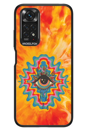 ThirdEye 2.0 - Xiaomi Redmi Note 11/11S 4G