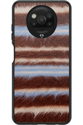 Soft Spot 2.0 - Xiaomi Poco X3 NFC