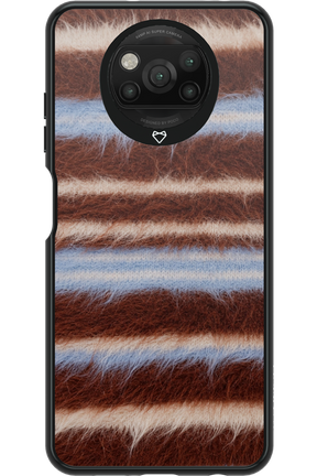 Soft Spot 2.0 - Xiaomi Poco X3 NFC