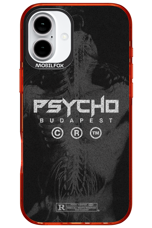 X-Ray - Apple iPhone 16 Plus