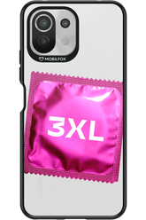 3XL 2.0 - Xiaomi Mi 11 Lite (2021)