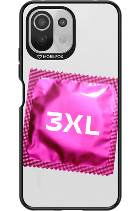 3XL 2.0 - Xiaomi Mi 11 Lite (2021)