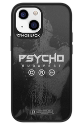 X-Ray - Apple iPhone 13 Mini