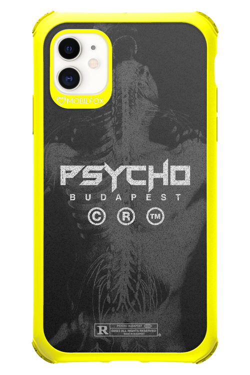 X-Ray - Apple iPhone 11