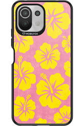 HAWAII 2.0 - Xiaomi Mi 11 Lite (2021)