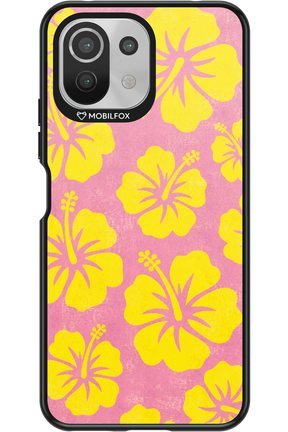 HAWAII 2.0 - Xiaomi Mi 11 Lite (2021)