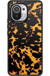 Tortoise Shell 2.0 - Xiaomi Mi 11 5G