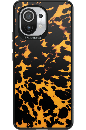 Tortoise Shell 2.0 - Xiaomi Mi 11 5G