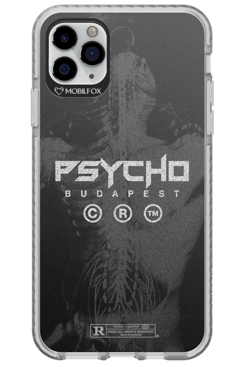 X-Ray - Apple iPhone 11 Pro Max