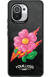 Your Loss 2.0 - Xiaomi Mi 11 5G