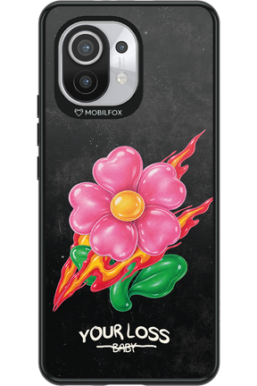 Your Loss 2.0 - Xiaomi Mi 11 5G
