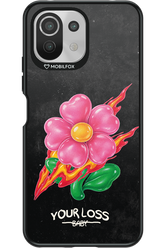Your Loss 2.0 - Xiaomi Mi 11 Lite (2021)