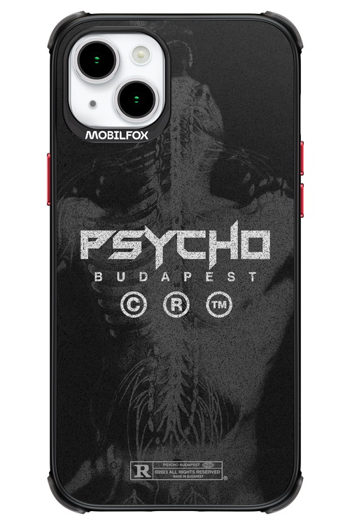 X-Ray - Apple iPhone 15 Plus