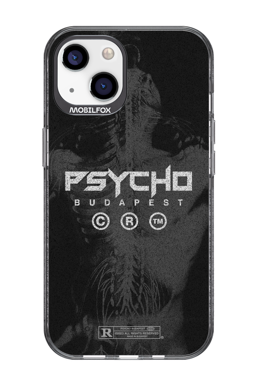 X-Ray - Apple iPhone 13