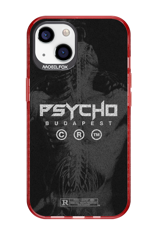 X-Ray - Apple iPhone 13