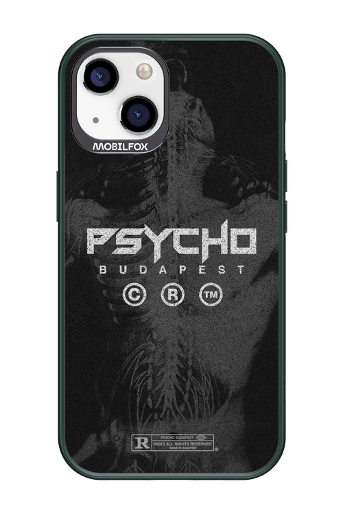 X-Ray - Apple iPhone 13